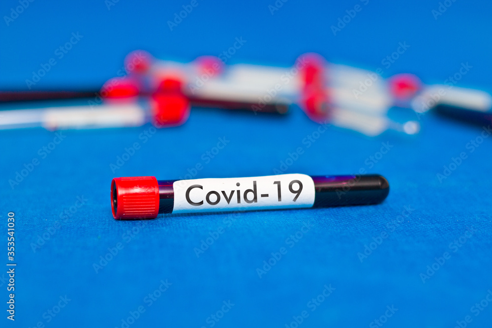 Blood test tube closeup with the inscription COVID-19 Blood test tube closeup with the inscription COVID-19