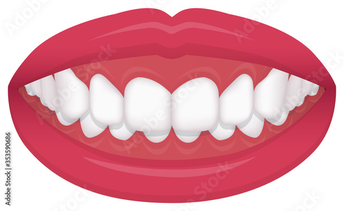 Teeth trouble ( bite type / crooked teeth ) vector illustration /Deep bite