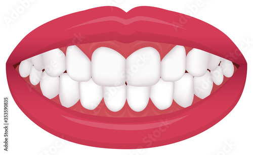 Teeth trouble ( bite type / crooked teeth ) vector illustration / even teeth., normal teeth
