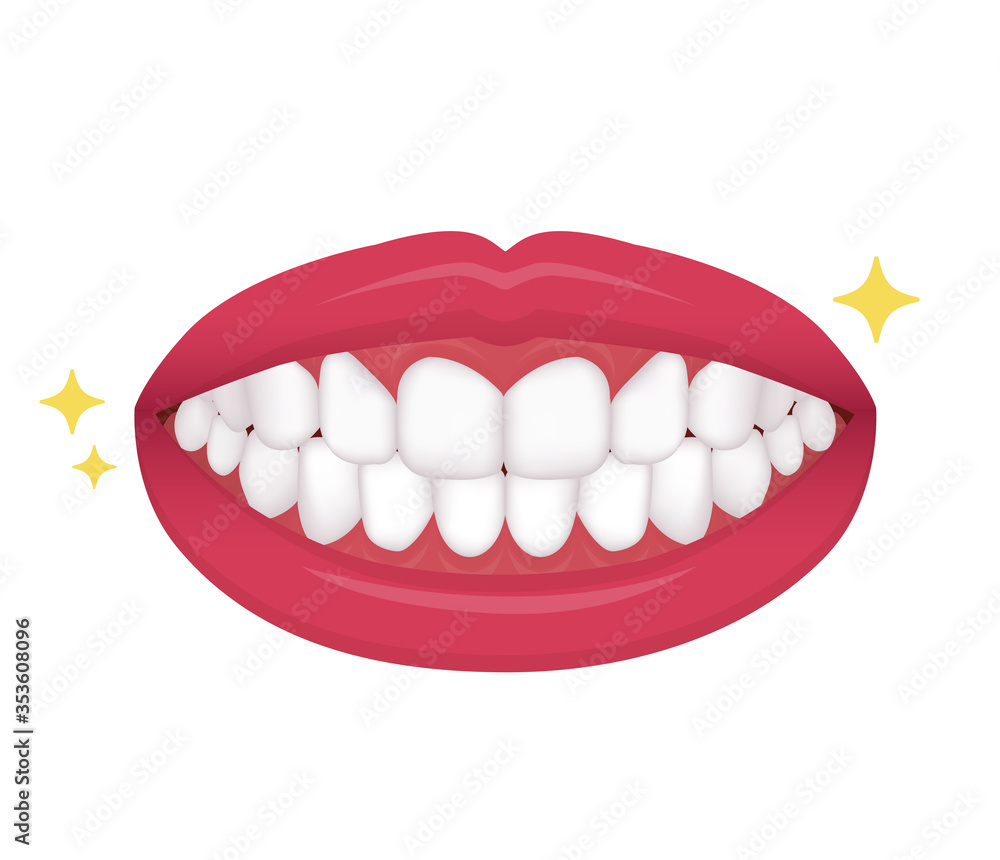 Dental braces vector illustration / no text Dental braces vector illustration / no text