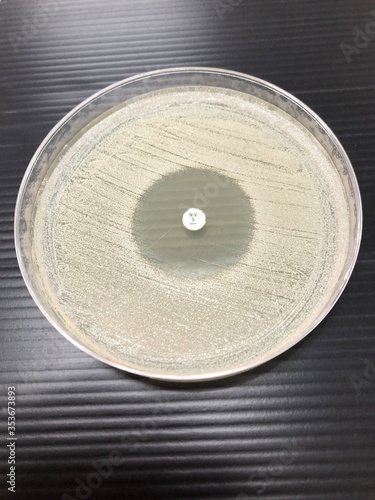 NOVOBIOCIN TEST : Staphylococcus aureus on Mueller hinton agar
