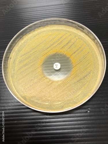 staphylococcus aureus and antisesceptibility testing
