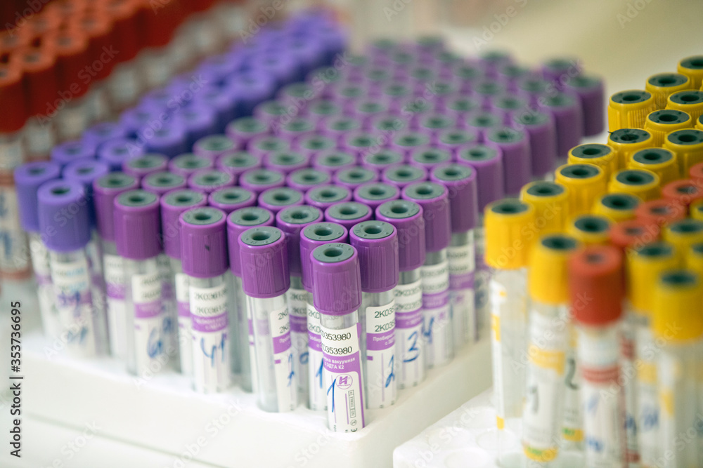 A medical laboratory takes a blood sample and tests for covid Stock ...