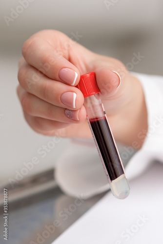 Close up of hand of doctor holding test tube with blood in the lab.