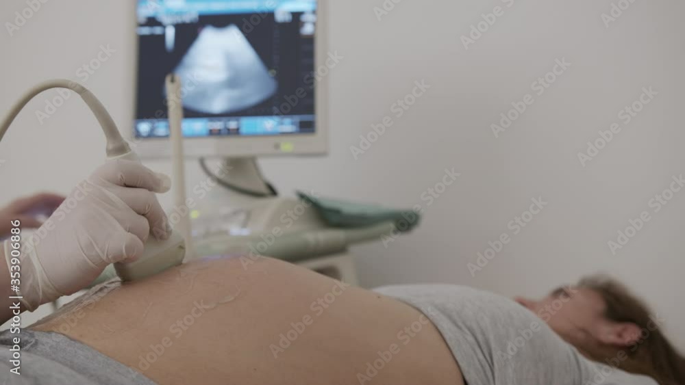Pregnant woman looking at procedure ultrasound scan of baby. Examination of baby at ultrasound. Pregnant woman looking at procedure ultrasound scan of baby. Examination of baby at ultrasound.