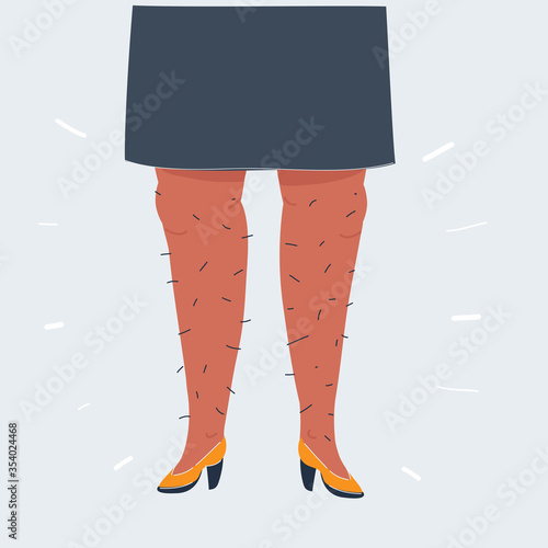 Illustration of pair of male or female hairy legs