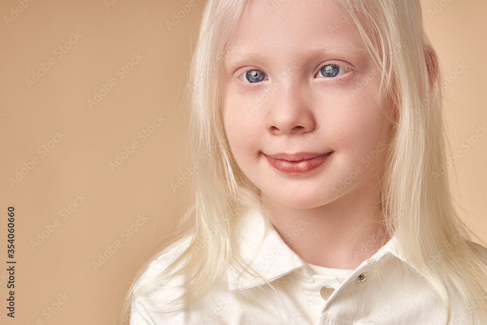 adorable albino girl 7-9 years old posing at camera isolated. shy little  caucasian child with unusual natural blonde hair and white skin born with  albinism Stock Photo | Adobe Stock
