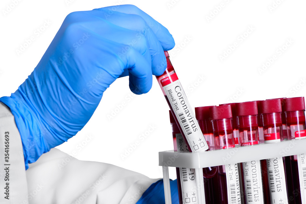 COVID-19 test and laboratory sample of blood testing for diagnosis coronavirus infection in the hands of the laboratory assistant COVID-19 test and laboratory sample of blood testing for diagnosis coronavirus infection in the hands of the laboratory assistant