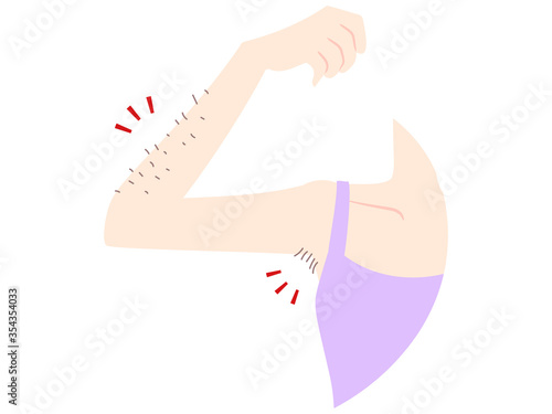 腋と腕のムダ毛