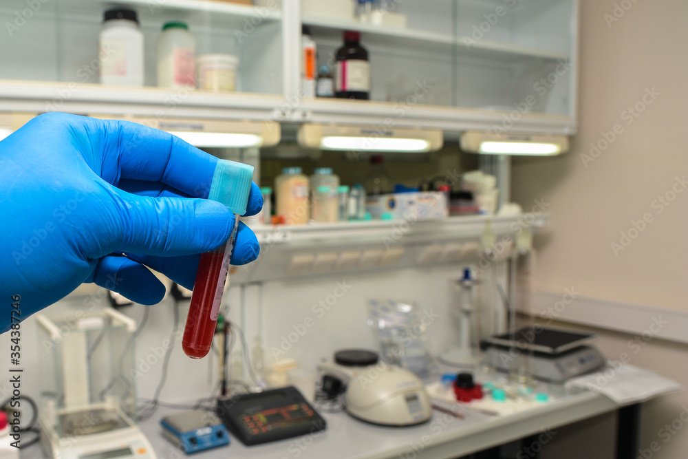 Laboratory testing of a biological sample. Laboratory testing of a biological sample.