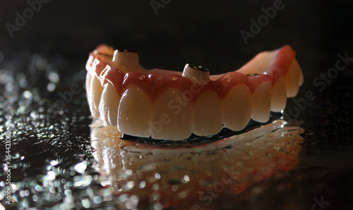 Implant oxide zirconia dental prosthesis