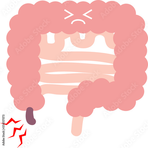 虫垂炎（盲腸）のイラスト　内臓　消化器
