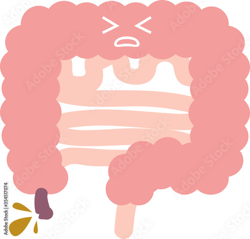 虫垂炎（盲腸）のイラスト　内臓　消化器