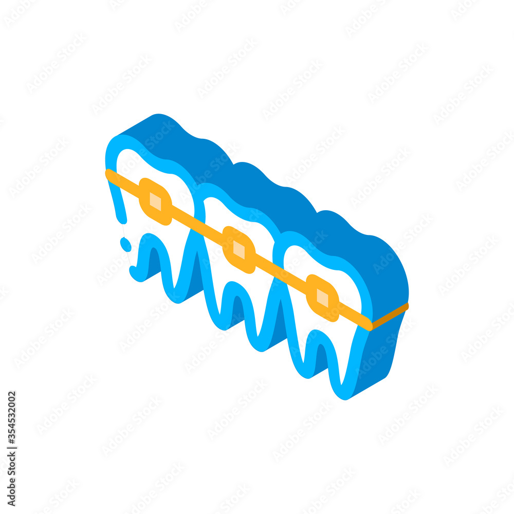 Fototapeta premium Dentist Stomatology Teeth Braces vector isometric sign. color isolated symbol illustration