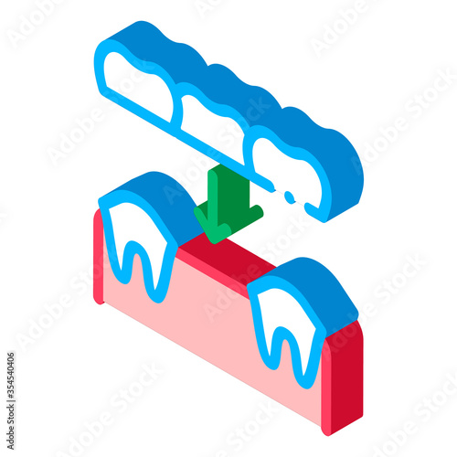 Dental Prosthesis Stomatology vector isometric sign. color isolated symbol illustration photo