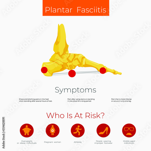 Plantar fasciitis anatomy scheme. Poster photo