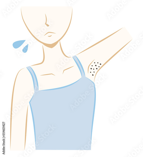 女性　脇　脱毛　黒ずみ　埋没毛　手描き風