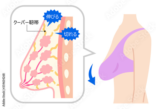 垂れたバスト　断面図と女性の体
