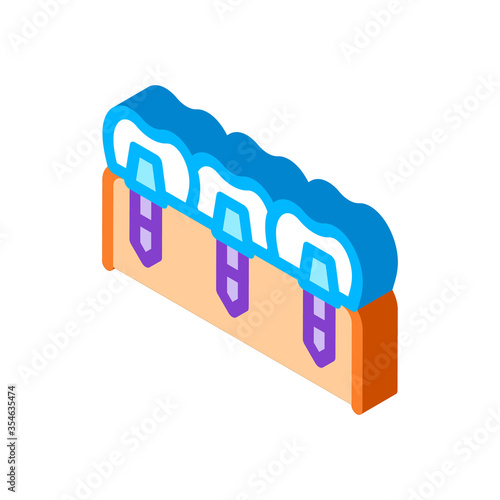 Dental Teeth Implants Biomaterial vector isometric sign. color isolated symbol illustration