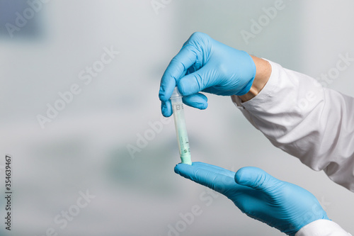 doctor's hand in medical gloves holds a tube for stool sample for colon cancer screening