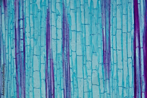 Corn ster l.s. under microscope