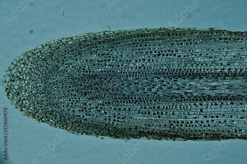 Mitosis onion root tip cells under microscope