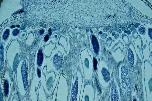 Moss antheridia l.s. under microscope photo