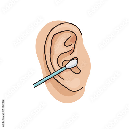Cleaning the ear canal with a cotton swab. Illustration of unhealthy habit. Removing earwax with cotton bud. Vector illustration of human ear closeup on white background. Realistic style