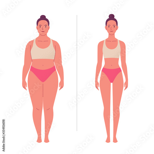 Weight loss. Vector illustration of cartoon young woman with overweight and slim body in underwear. Isolated on white.
