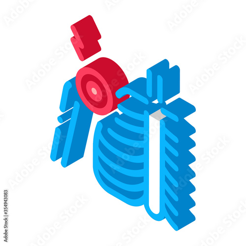 arthritis of shoulder joint icon vector. isometric arthritis of shoulder joint sign. color isolated symbol illustration