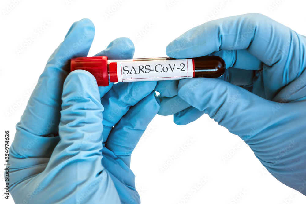 Test tube vaccine coronavirus SARS-CoV-2