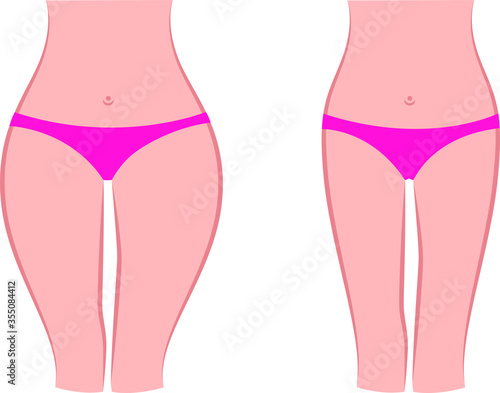 Fat and slim woman before and after weight loss Stock vector illustration
