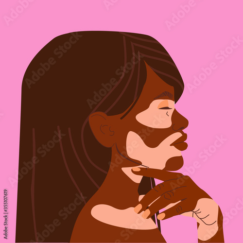 Portrait of a beautiful black woman with vitiligo. Avatar of a young African girl with pigmentation on the skin of her face and hands. Bodypositive concept. Stock Vector illustration isolated on pink.