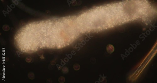 Amoebae move and feed by using pseudopods, which are bulges of cytoplasm formed by the coordinated action of actin microfilaments pushing out the plasma membrane that surrounds the cell.
 photo