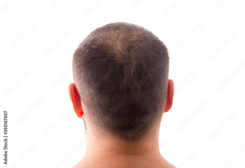 Obraz premium against hair loss