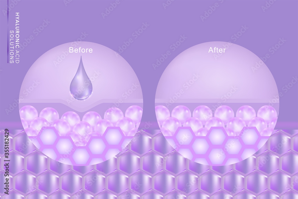 Hyaluronic acid before and after skin solutions ad, purple collagen serum drop with cosmetic advertising background ready to use, illustration vector.