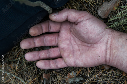 Murder in the woods. The hand of a dead man in the forest needles. Violent attack. Victim of crime.