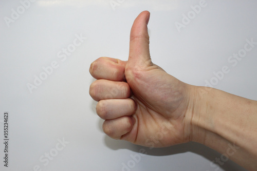 Demonstration of hypermobility of a thumb in the 