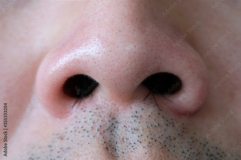 Young man's nose His nostrils are hairy. . Health and medical concepts