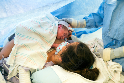 Cesarean Section C-Section patient mother holds newborn baby for first time in delivery room of hospital with skin to skin contact wearing masks due to Covid-19 pandemic