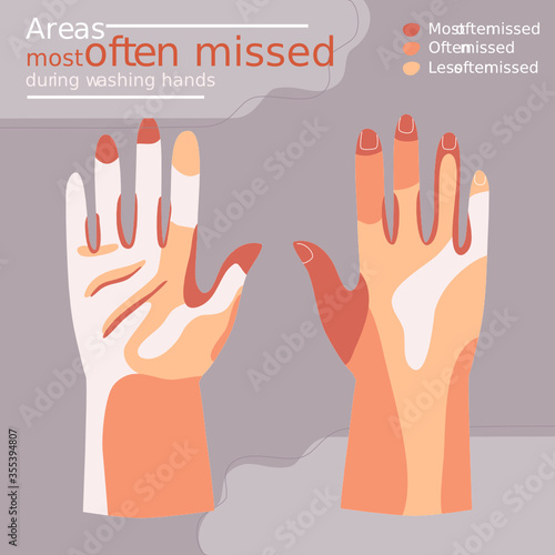 Flat style vector illustration of Area most often missed during washing hands infographic. Concept of how to cleaning hands to avoid germs and virus. 