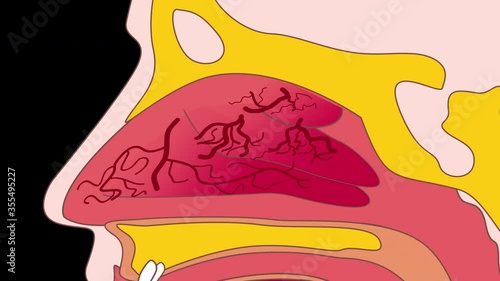 Nasal congestion 4K, alpha channel	