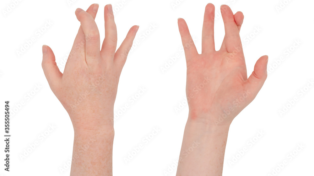 Freckled white hands. Isolated woman's hand in a fingers crossed gesture, all other fingers spread out. Front and back Freckled white hands. Isolated woman's hand in a fingers crossed gesture, all other fingers spread out. Front and back