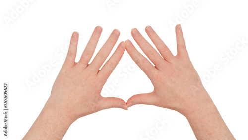 Freckled white hands,  making a diamond or kite frame between thumb and index finger with fingers splayed, palms down.  Female hand isolated