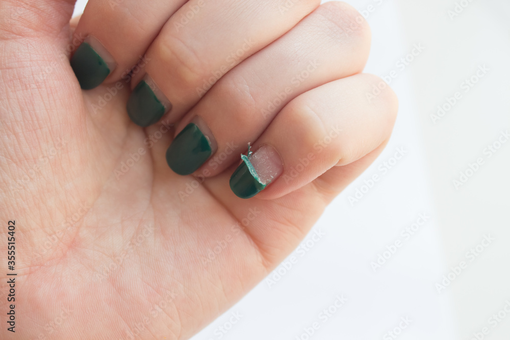 Woman with old gel polish manicure. Damaged, peeling, shabby gel polish Woman with old gel polish manicure. Damaged, peeling, shabby gel polish