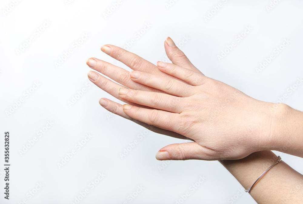 worn fingers on white background