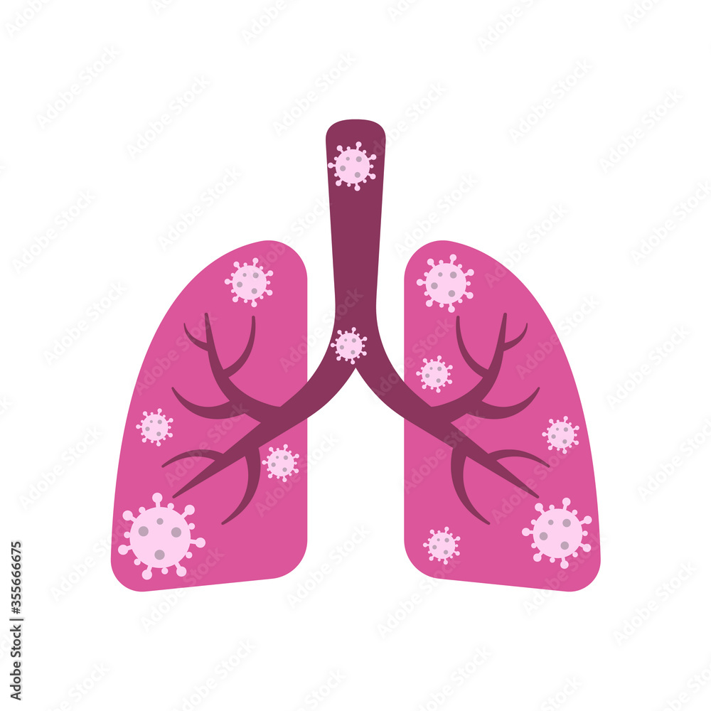 Lungs, bronchi, trachea infected with virus, bacterium, microbes. Vector illustration, flat cartoon design, eps 10.