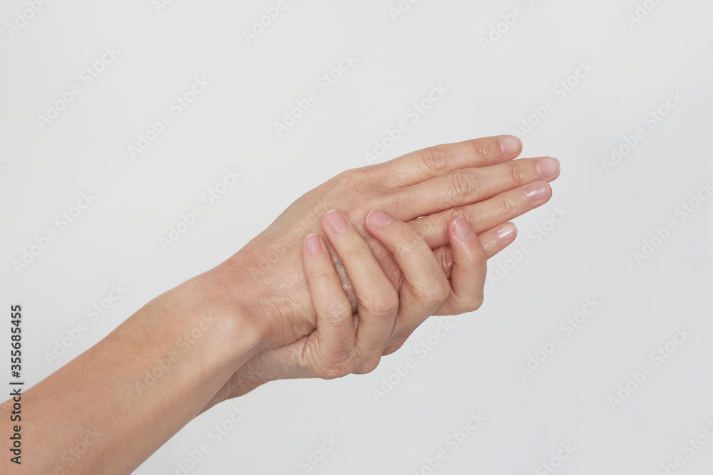 applying hand cream on dry hands with eczema