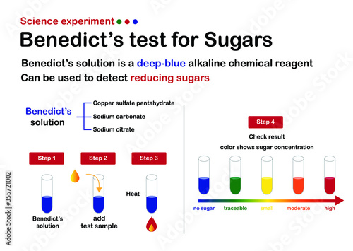 Science experiment diagram show Benedict's test for sugar determination with result analysis.