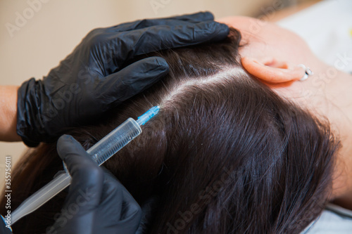 Unrecognizeble female person at trichologist office get injections in head skin. Doctor's hands holding disposable syringe under patient's head. Porcedure against hair loss and for skin health.